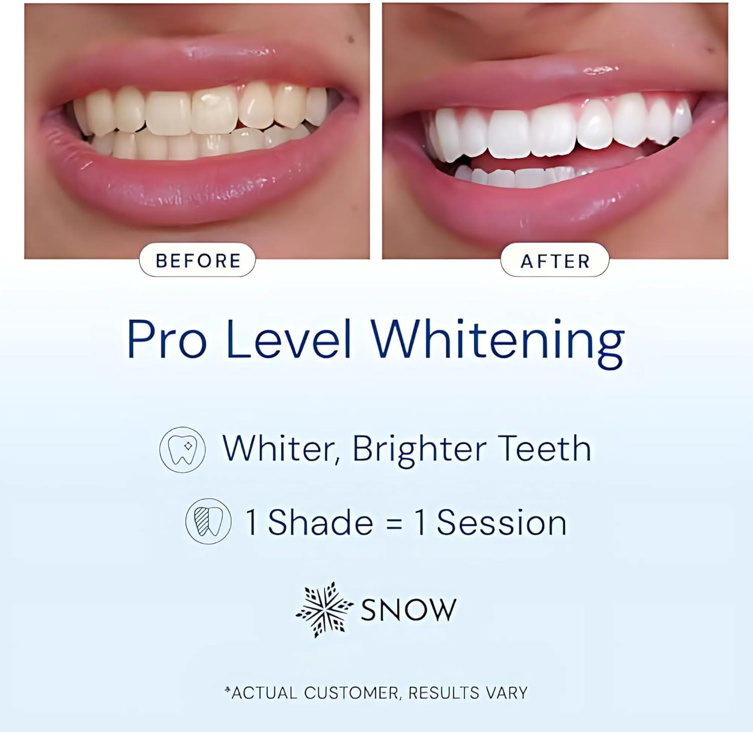 image:imageSnow Teeth Whitening Kit Snow Teeth Whitening Serum and LED Mouthpiece Whitener Formulated with Hydroxyapatite Good for 2 Months Wireless Kit with 1 Wand