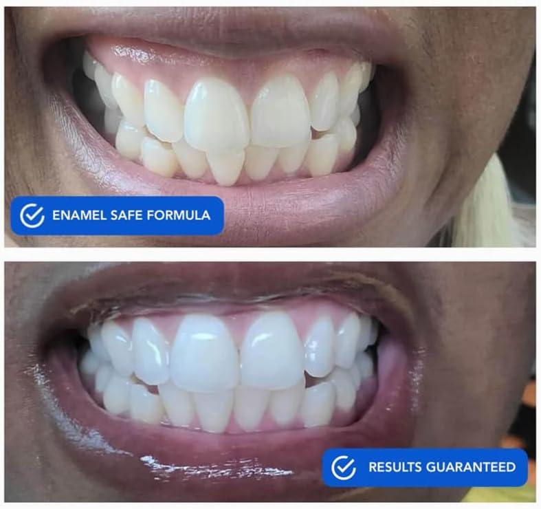 image:imageSNOW Diamond Dissolving Teeth Whitening Strips Gentle amp Enamel Safe White Strips for Teeth Whitening atHome Dental Hygiene amp Tooth Care with Hydroxyapatite 42 Ct42 Count Pack of 1