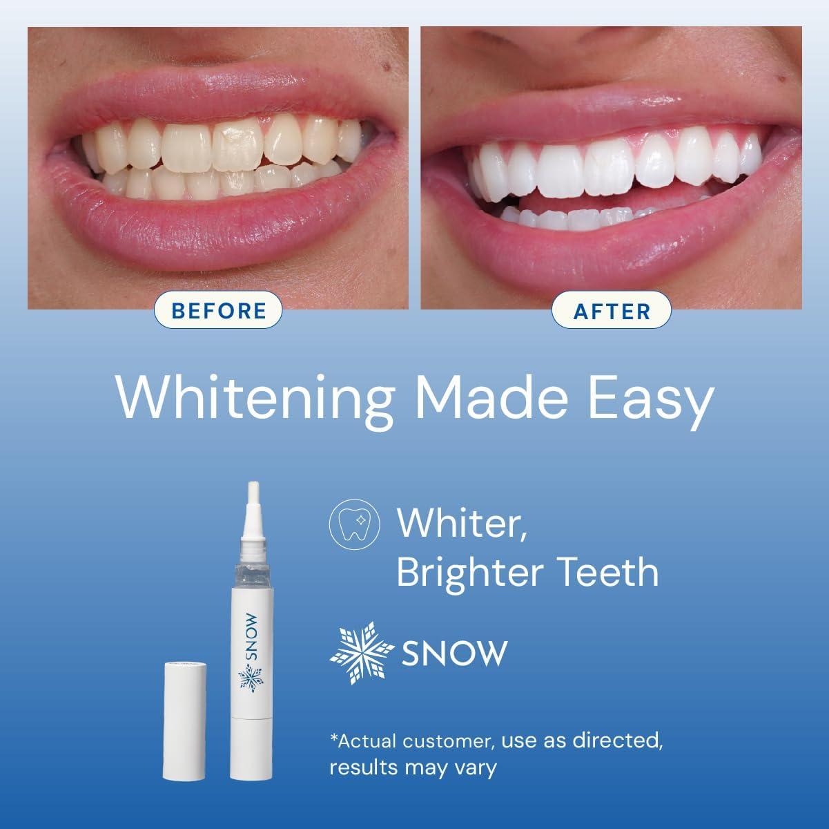 image:imageSNOW DiamondSeries Wand Helps Keep Your Smile Clean and Refreshed with EasytoUse Travel Size 2 ml Perfect for OnTheGo