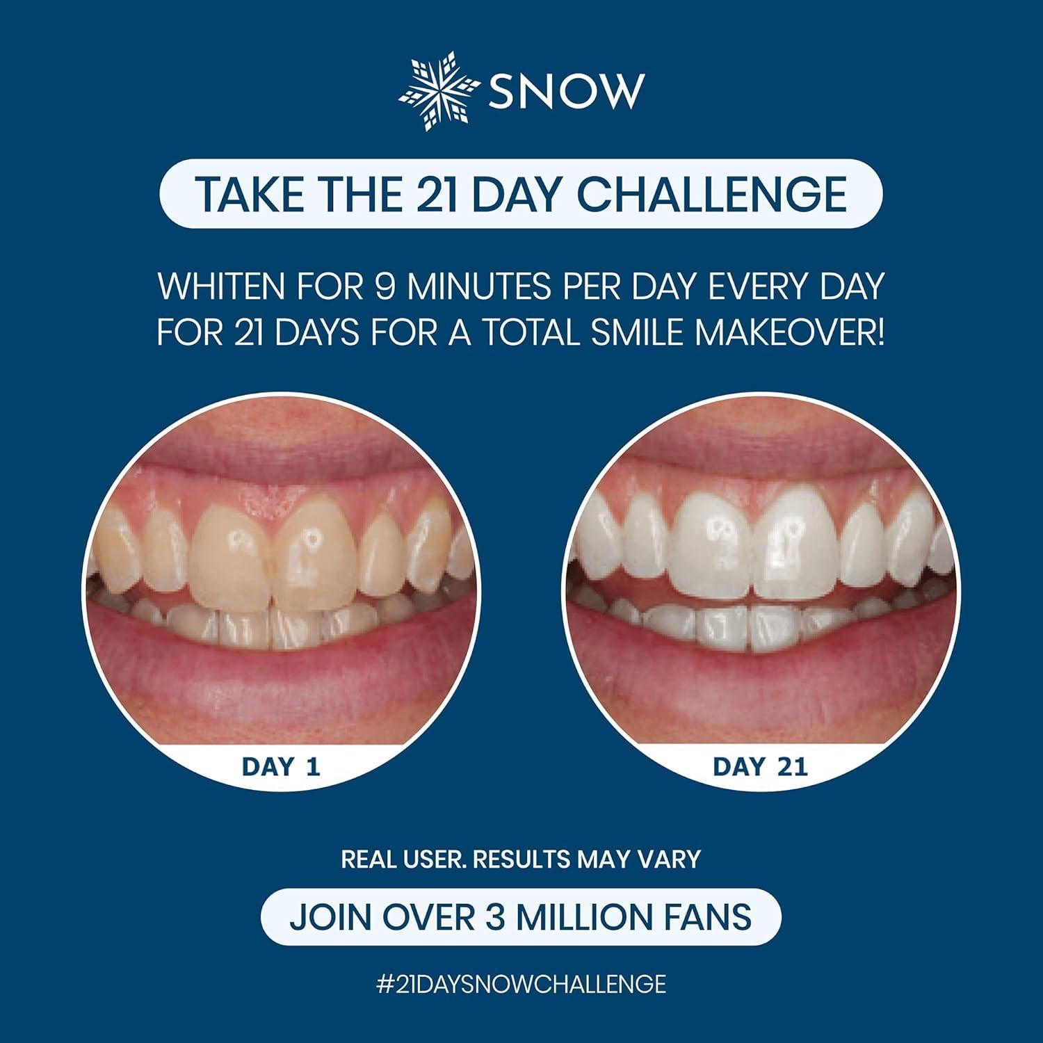 image:imageSnow Teeth Whitening Kit Snow Teeth Whitening Serum and LED Mouthpiece Whitener Formulated with Hydroxyapatite Good for 2 Months Wired Kit with 1 WandDiamond Wired 3 Wand