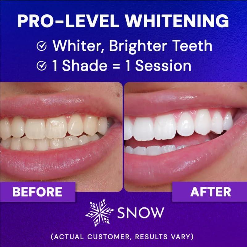 image:imageSnow Diamond Series Teeth Whitening Kit 75 Treatments for Sensitive Teeth Advanced Whitening Serum